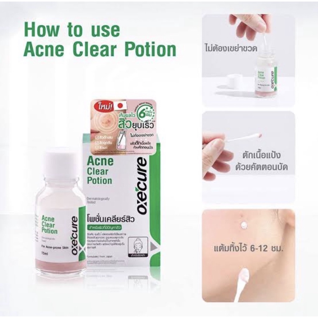 oxecure-acne-clear-potion-อ๊อกซีเคียว-แอคเน่-เคลียร์-โพชั่นแต้มสิว-รักษาสิว-บำรุงผิวหน้า-ขนาด-15-ml