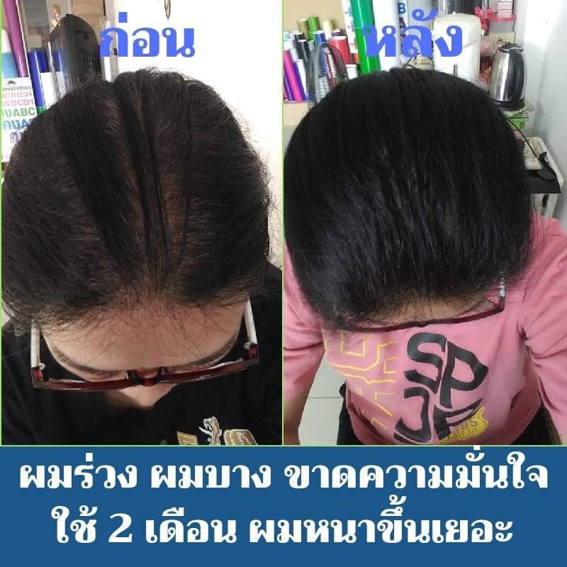 ภาพสินค้าปลูกผม ลดหลุดร่วง เร่งผมยาว แก้ผมร่วง แฮร์โทนิค hair tonic ลีกาโน่ legano บำรุงรากผมใหม่ให้แข็งแรง 120 มล.จำนวน 1 ขวด จากร้าน warobonpanwor บน Shopee ภาพที่ 6