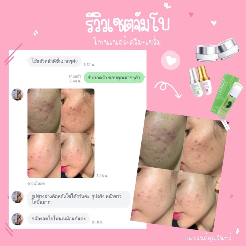 โทนเนอร์ลดสิว-ขนาด-60-ml-deproud-ส่งฟรี-มีของแถม