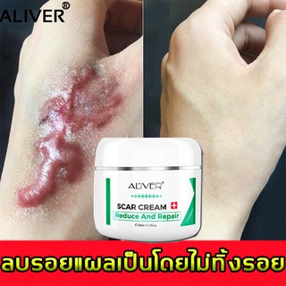 ALIVERครีมลดรอยแผลเป็น50ml รอยแผลเป็นจางลงและช่วยสมานผิว ครีมกำจัดรอยแผลเป็น ครีมลดรอยแผลเป็น ครีมรักษาแผลเป็น ครีมซ่