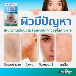 ภาพขนาดย่อของภาพหน้าปกสินค้าHealthway Liver tonic 35000 mg สวยใส จากภายใน บรรจุ 100 เม็ด EXP 3/2026 จากร้าน meevitamin18 บน Shopee ภาพที่ 6