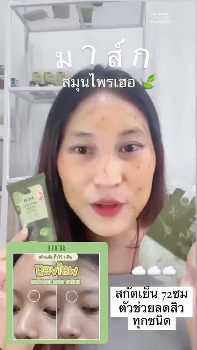 พร้อมส่งเบบี้เฮิร์บ-1ซอง-baby-herb-ตัวช่วยลดสิวที่ดีที่สุดตอนนี้