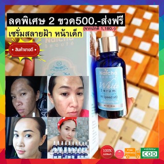 ((2ขวด ของแท้ ส่งฟรี)) เซรั่มณัชชา serum Natcha White ขนาด 30ml 1 ขวด ฝ้า กระ สิว หน้าดำ รีบสั่ง 5ปีแล้วเซรั่มณัชชา