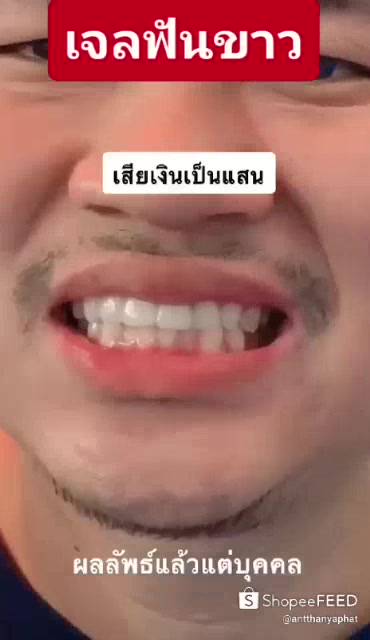 1แถม1-ส่งฟรี-ไม่ต้องใช้โค้ด-เจลฟอกฟันขาว-ยาสีฟันฟอกฟันขาว-dental-switz-ฟันขาวฟอกเองที่บ้าน