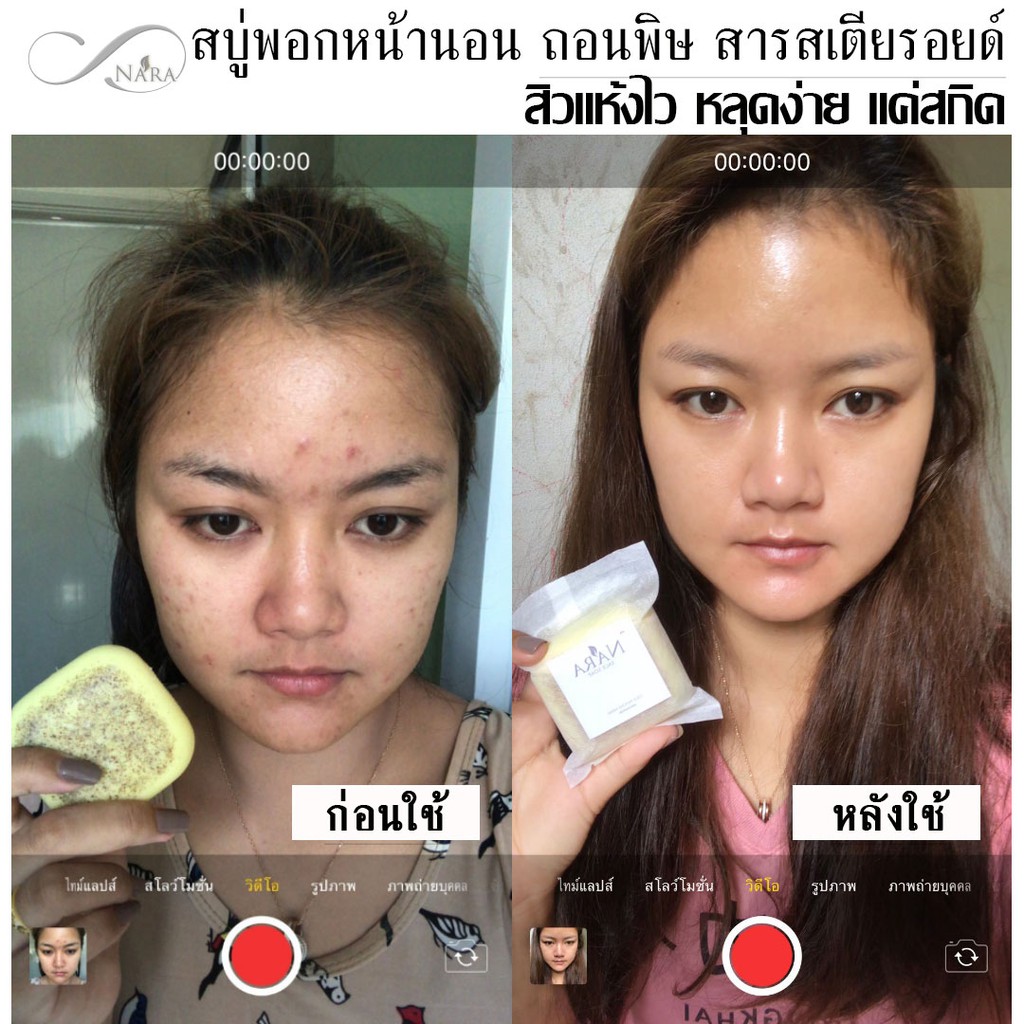 ภาพหน้าปกสินค้าNARA สบู่พอกหน้านอน ไข่ขาว+ถั่วเขียว ถอนพิษ แก้แพ้ รักษาผิวติดสารสเตียรอยด์/ สมุนไพรสกัดเย็น รักษาสิวหนักทุกชนิด