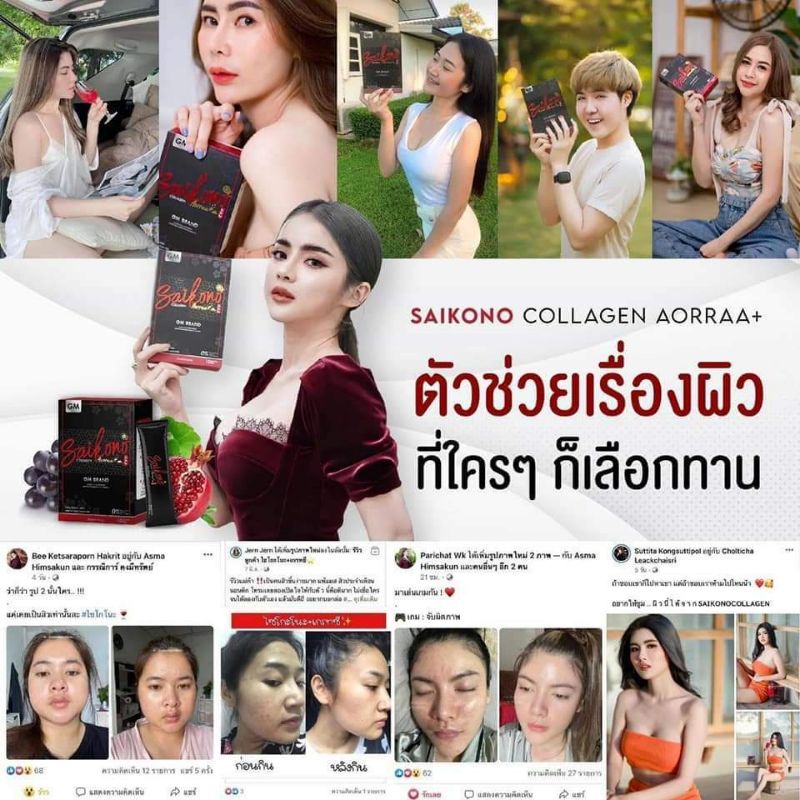 ส่งฟรี-ของแถม-ไซโกโนะคอลลาเจน-พลัส-คอลลาเจนลดสิว-ผิวใส-ลดริ้วรอย-หมองคล้ำ-ช่วยให้ผิวดูอ่อนกว่าวัย-ของแท้100