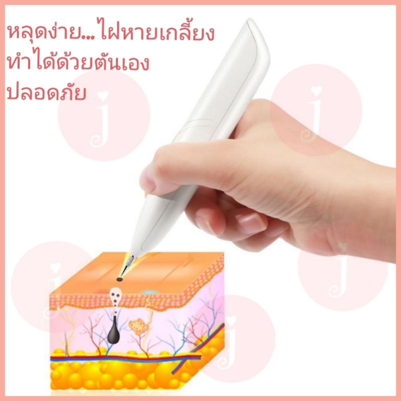 ปากกาจี้ไฝ-ขี้แมลงวัน-หูด-ติ่งเนื้อ-จุดดำ-รุ่นต่อสายตรง-แถมฟรีครีมบำรุงหลังจี้-mini-pen-freckle-remove-เครื่องจี้ไฝ