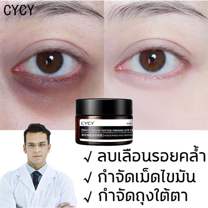cycyอายครีม-ครีมบำรุงรอบดวงตา30gให้ความชุ่มชื่นขอบตาดำถุงใต้ตารอยตีนการิ้วรอยร่องแก้ม-ลดริ้วรอยeye-cream