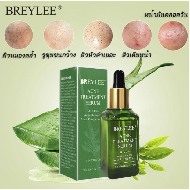 ของแท้-breylee-เซรั่มลดสิว-ครีมลดสิว-ครีมแต้มสิว-เจลแต้มสิว-เจลรักษาสิว-ครีมกำจัดสิว-ครีมรักษาสิว-ครีมสลายสิว-กำจัดสีว