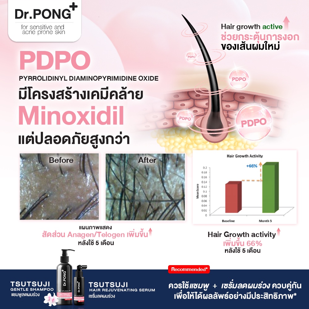 ภาพสินค้าDr.PONG TSUTSUJI HAIR REJUVENATING SERUM - anti-hairloss serum เซรั่มบำรุงผม ลดผมร่วง จากร้าน drpongshop บน Shopee ภาพที่ 4