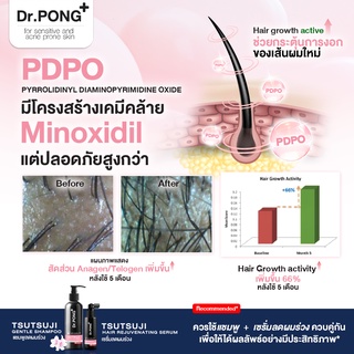 ภาพขนาดย่อของภาพหน้าปกสินค้าDr.PONG TSUTSUJI HAIR REJUVENATING SERUM - anti-hairloss serum เซรั่มบำรุงผม ลดผมร่วง จากร้าน drpongshop บน Shopee ภาพที่ 4