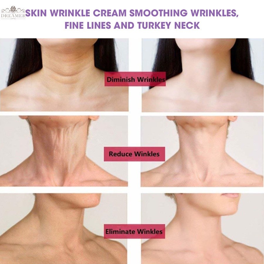 dreamer-anti-wrinkle-collagen-cream-firming-neck-whitening-remove-dark-circles-facial-cream-anti-aging-moisturizing-face-skin-care