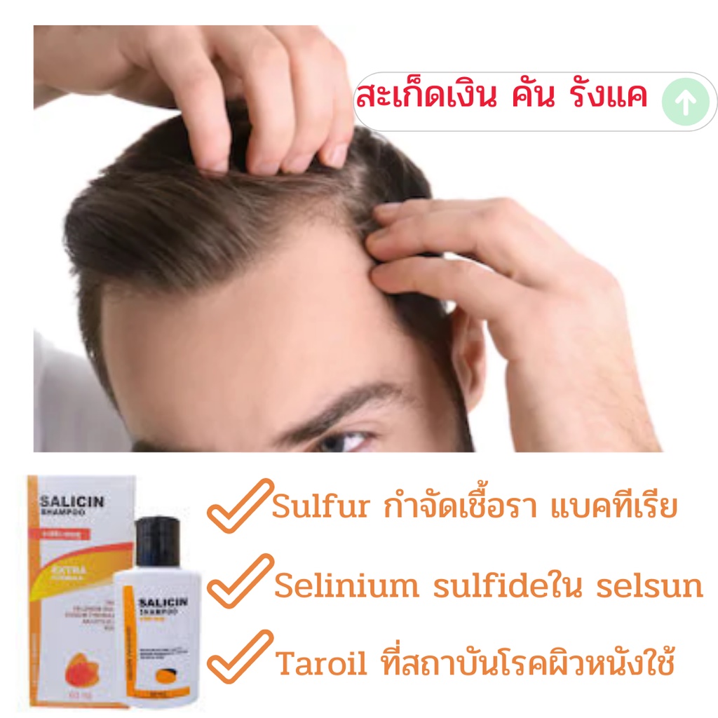 salicin-shampoo-60-ml-แก้คัน-เชื้อราบนหนังศรีษะ