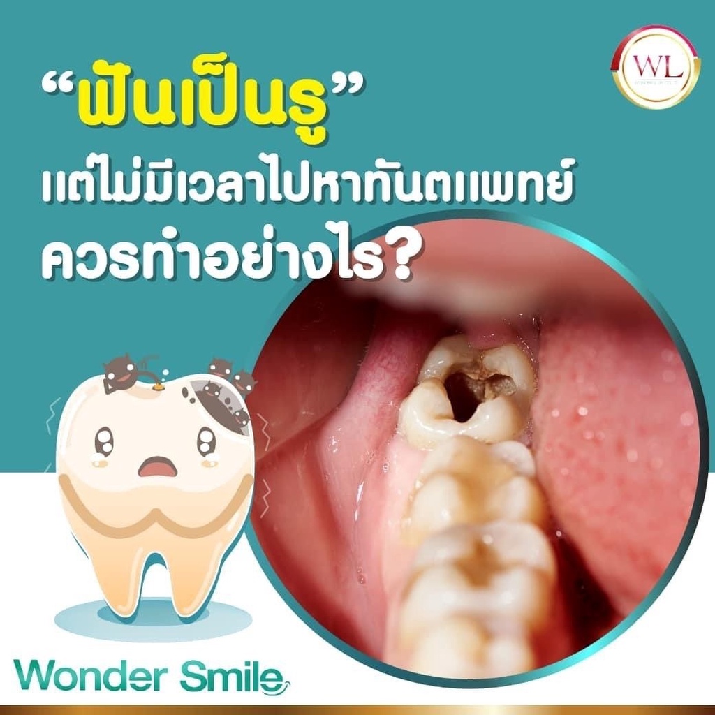 3แถม6-wonder-smile-วันเดอร์-สไมล์-ยาสีฟันฟอกฟันขาว-ของแท้-100-ส่งฟรี