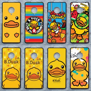 เคส Vivo NEX 3 ลายเป็ดน้อยน่ารัก ขอบนิ่มหลังแข็ง เคส ถือ เคส Caseเคส TPU ขอบนิ่มหลังแข็ง ไม่ขูดตัวเครื่อง ไม่กัดขอบช่วยป