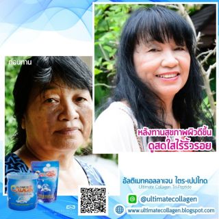 ภาพขนาดย่อของภาพหน้าปกสินค้าอัลติเมทคอลลาเจน ultimate collagen บรรจุ120 กรัม 5 ซอง จากร้าน utimate บน Shopee ภาพที่ 3