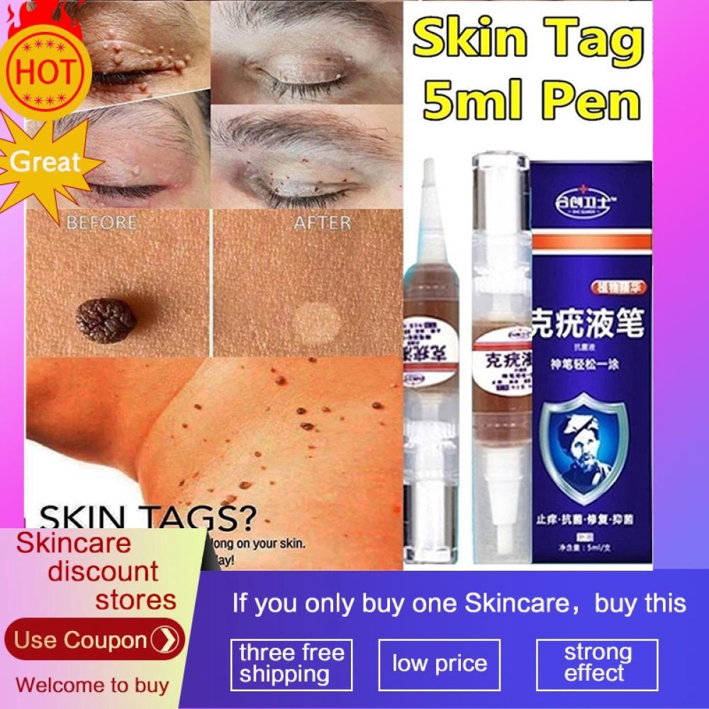 body-warts-treatment-cream-skin-tag-remover-foot-corn-removal-plantar-genital-warts-ointment-footครีมกำจัดหูดที่ผิวหนัง