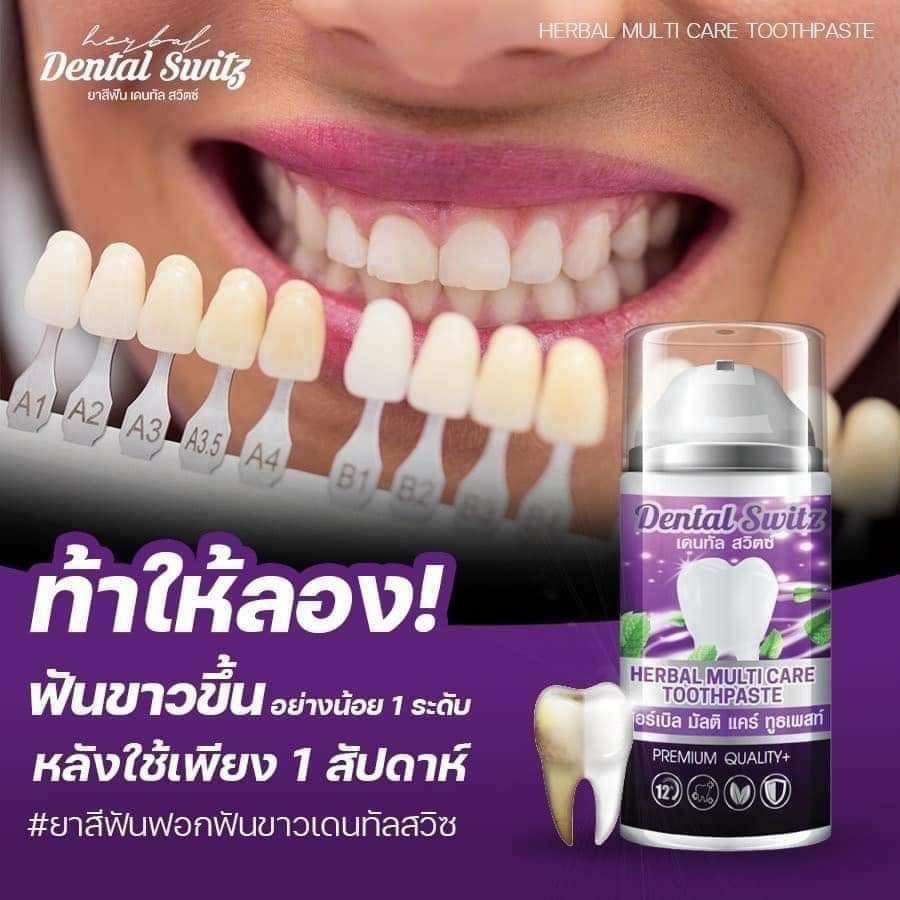 2-แถม-2-ของแท้-ยาสีฟัน-dental-switz-เจลฟอกฟันขาว-ยาสีฟันฟอกฟันขาว-กลิ่นปาก-หินปูน-ฟอกฟันเองที่บ้าน-แบบมีราง