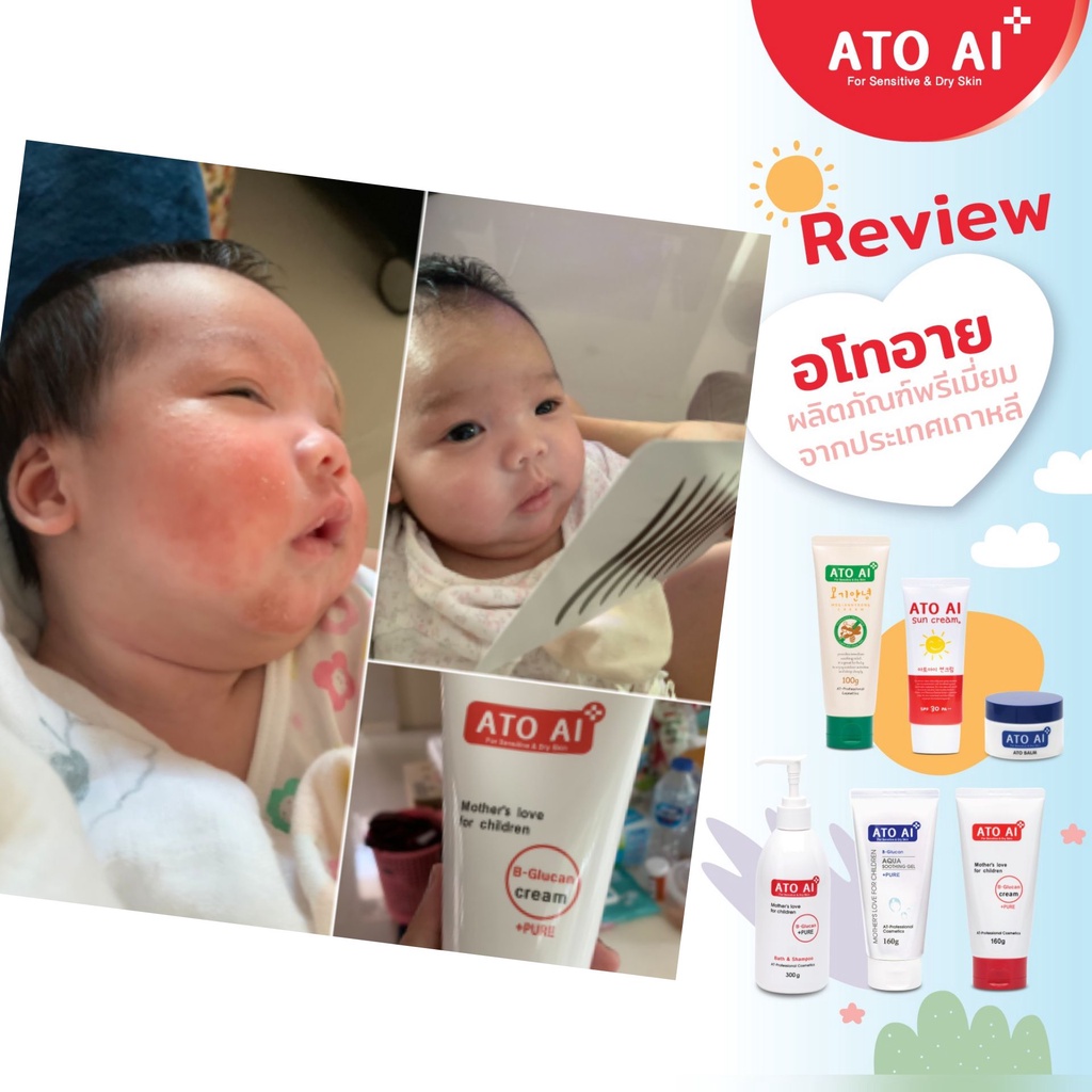 ครีมลดผดผื่น-ผิวแห้ง-ผิวแพ้-ครีมทาผิวเด็ก-อโทอายนำเข้าจากเกาหลี-ใช้ได้ตั้งแต่แรกเกิด-160-กรัม-นำเข้าจากเกาหลี