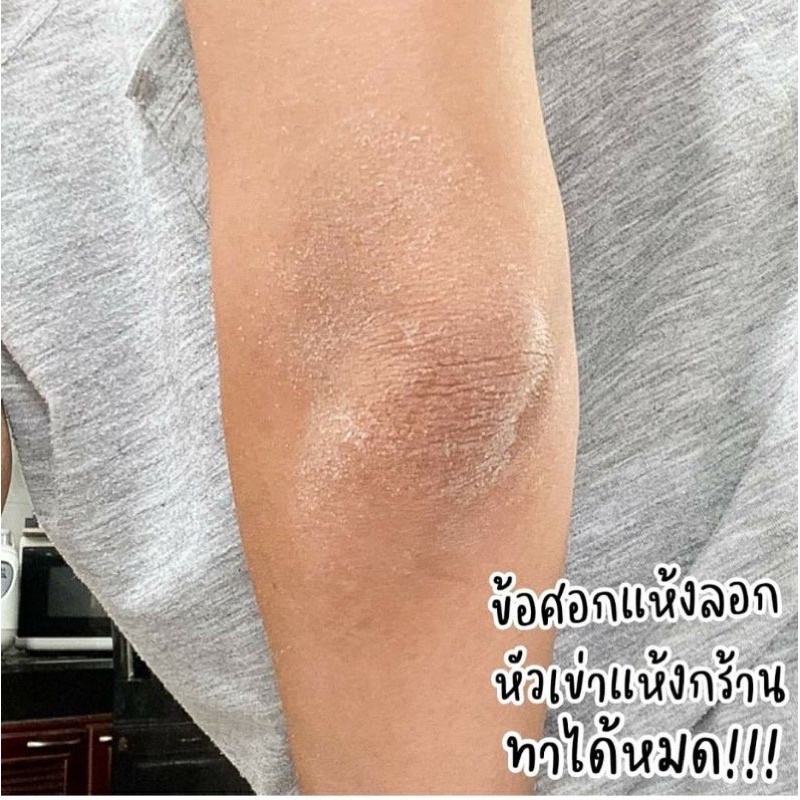 bio-oil-เนื้อเจล-ไอเทมสำหรับคนผิวแห้ง-ช่วยเพิ่มความชุ่มชื้นให้ผิว-ทากันท้องแตก-ทาผิวแตกลาย-ข้อศอก-ตาตุ่มได้หมดขนาด50ml