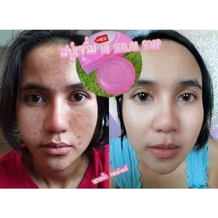 สบู่เซรั่มnb-สบู่nb-สบู่เนเงินครูเบียร์-สบู่ครูเบียร์