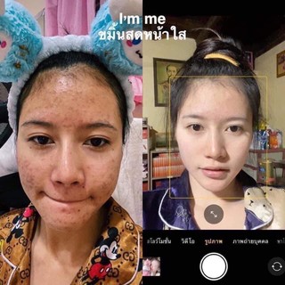 ถ้าพูดถึงความ หน้าใส ไร้สิว  #ครีมขมิ้นสด 𝐈𝐌 𝐌𝐄 〽️  สินค้าขายดี.. ตัวดังใน #Tiktok 🔥  • การันตียอดขาย 8 แสนกระปุก