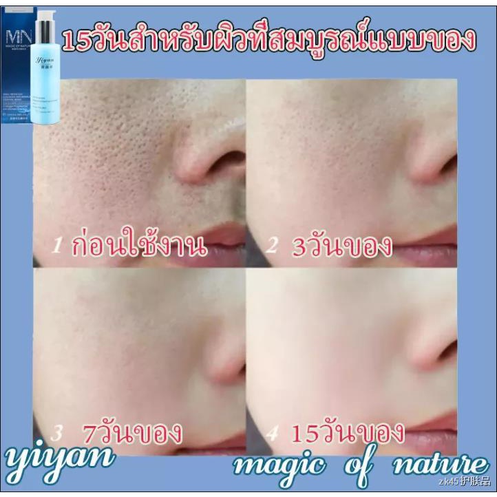 yiyan-รูขุมขนหดตัวสาระสำคัญ-120ml-รูขุมขนกระชับขึ้-เซรั่มกระชับใบหน้า-รูขุมขนหดตัว-เซรั่มไฮย