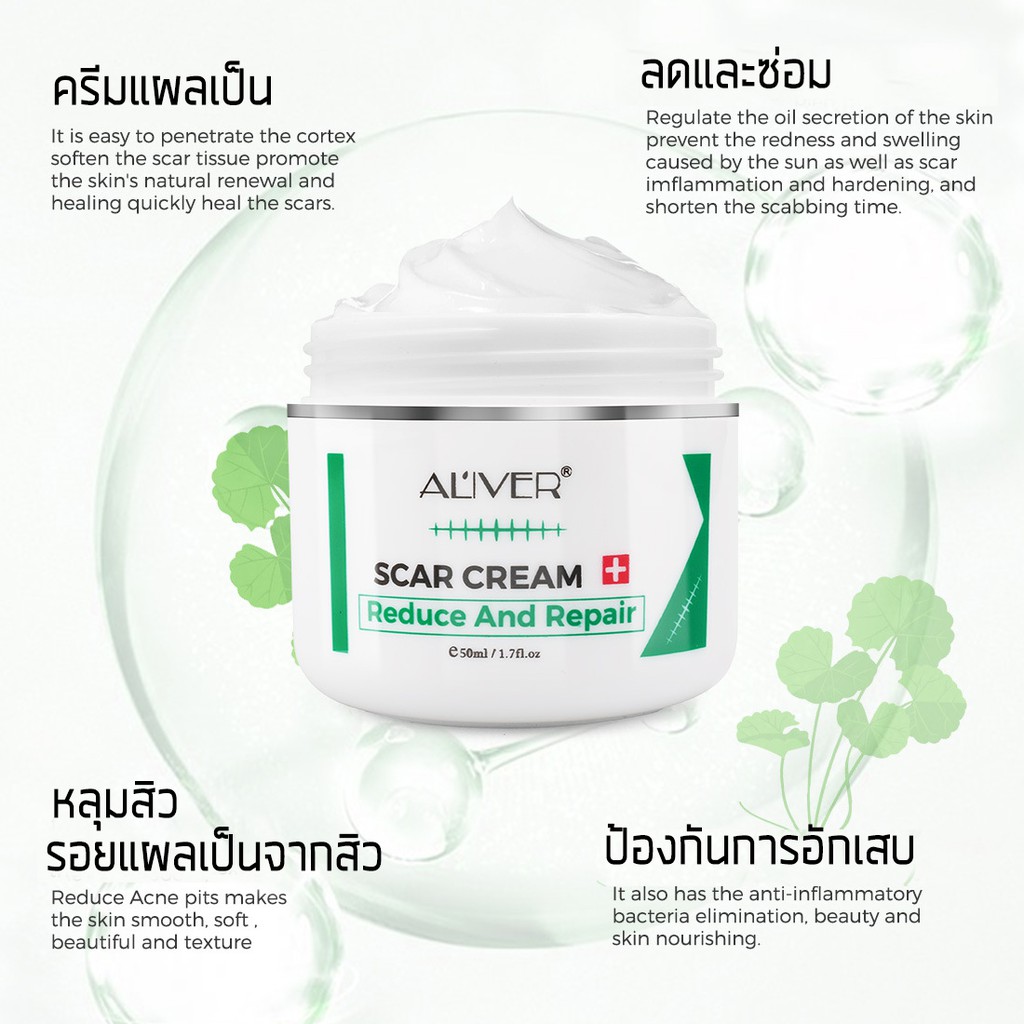 aliver-50ml-ครีมกำจัดรอยแผลเป็น-เจลลดรอยแผลเป็น-ครีมกำจัดรอยแผลเป็น-ครีมลดรอยแผลเป็น-ครีมลบรอยแผลเป็น-ครีมลดแผลเป็น