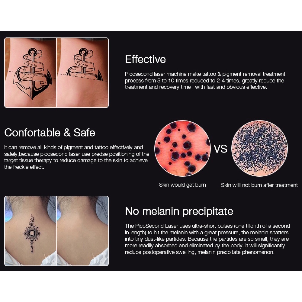ภาพสินค้าเลเซอร์ Picosecond ปากกา Freckle Tattoo Removal Mole Dark Spot คิ้ว Pigment เลเซอร์รักษาสิว Beauty Care จากร้าน hsl_beauty บน Shopee ภาพที่ 8