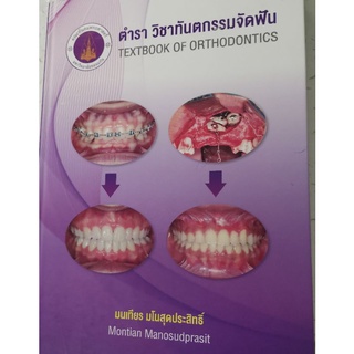 ตำราวิชาทันตกรรม​จัดฟัน Orthodontic textbook