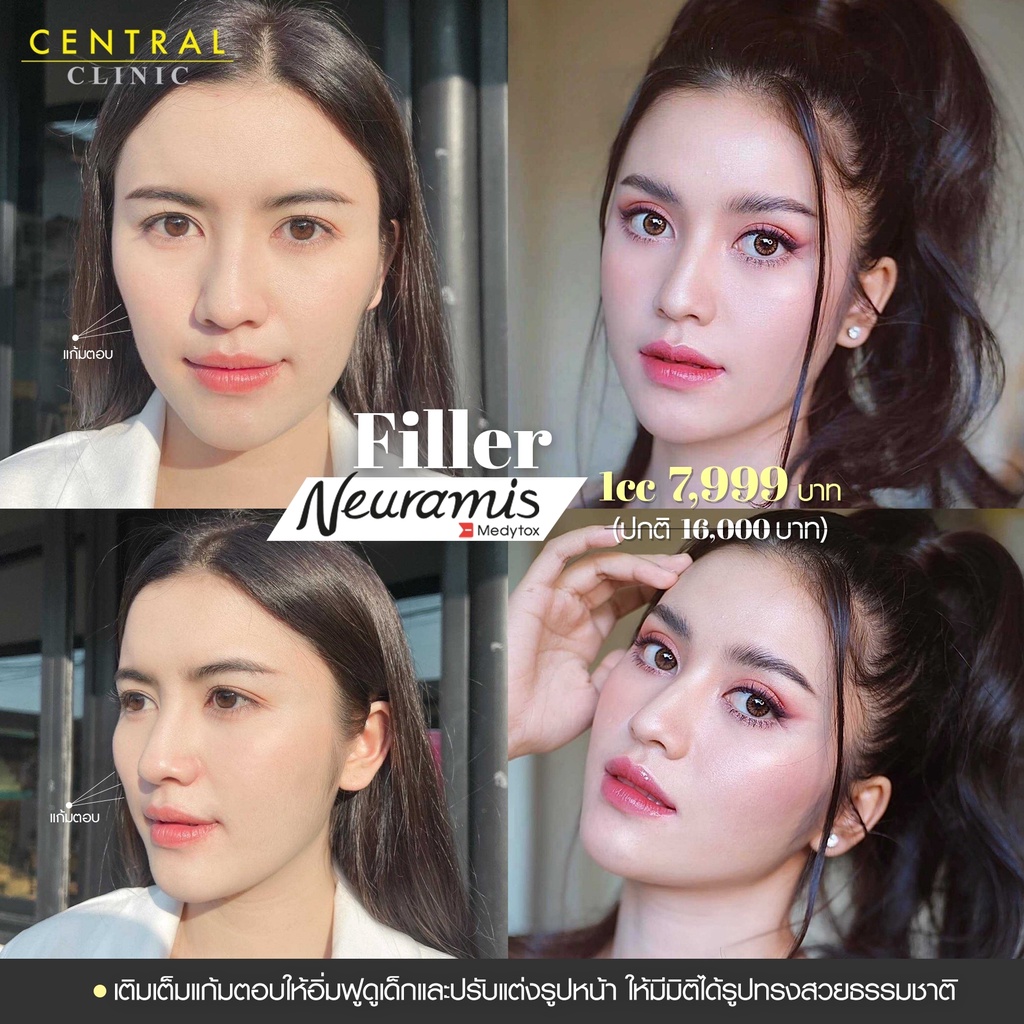 ภาพหน้าปกสินค้าโปรแกรมผ่อนชำระ 15,000 บาท Installment Payment Voucher จากร้าน centralclinic_official บน Shopee