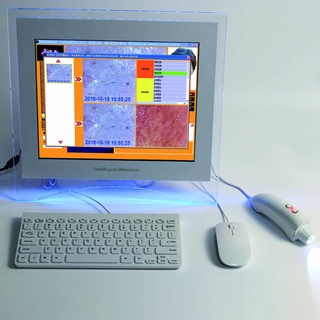 3D Skin Analyzer / High Resolution Skin Scanner / Facial Skin Analyzer / Skin Wrinkle Analyzer Color / Acne Analysis / S