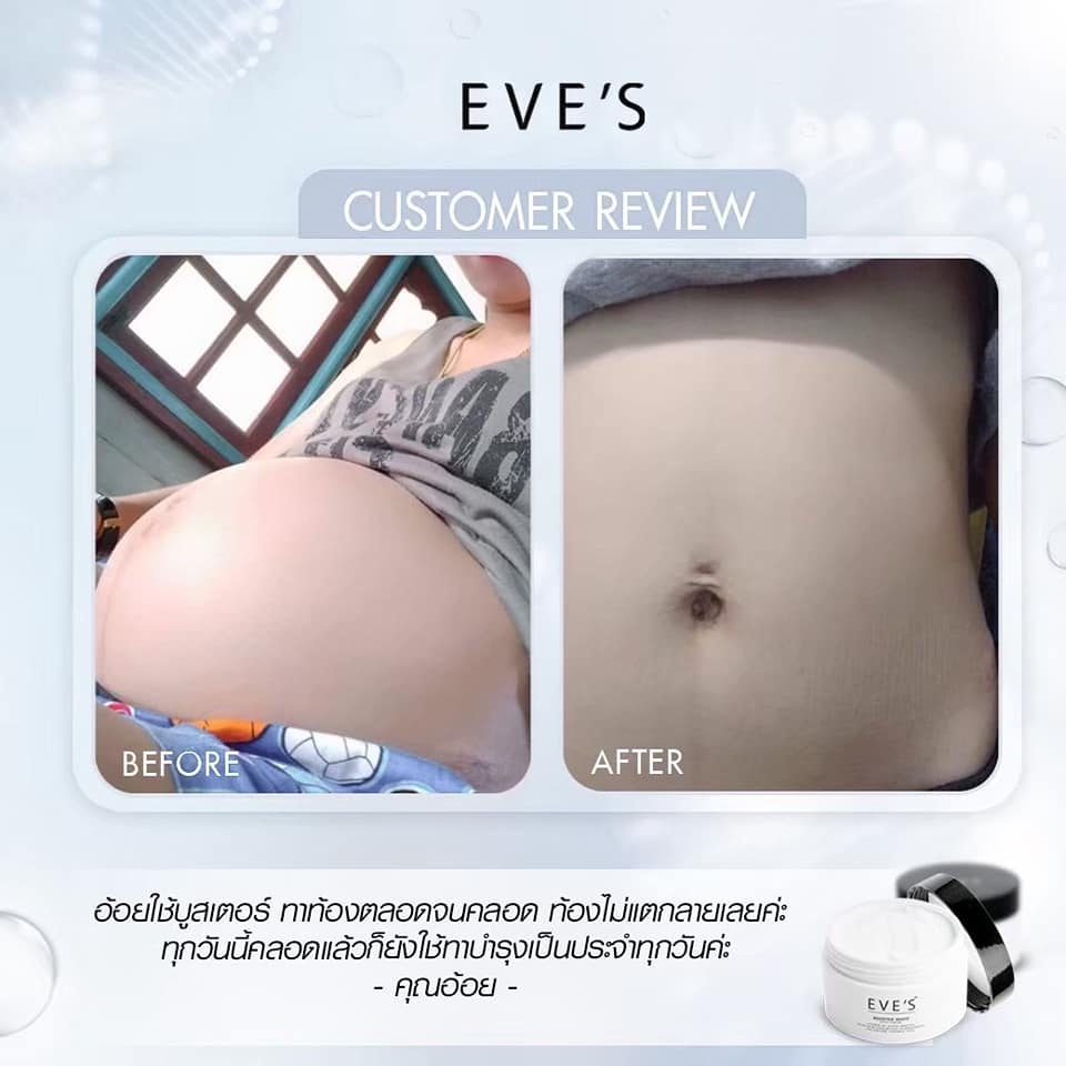 eves-ลดรอยแตกลาย-ก้นลาย-ขาลาย-รักแร้ดำ-จุดด่างดำ-ผิวแห้ง-ผิวแตก-ผิวลอก-white-body-cream-ครีมผิวขาวใส