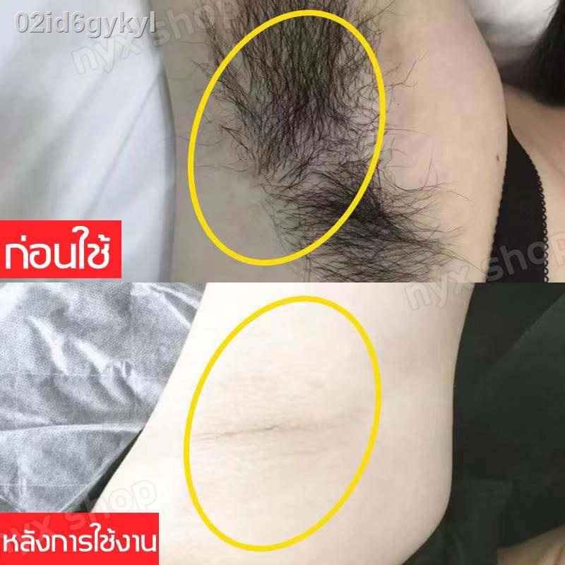 จัดขนใน-1-นาที-เครื่องกำจัดขน-กำจัดขนถาวร-มีดโกนขนหมอย-เครื่องโกนขนไฟฟ้า-ที่โกนหมอย-เหมาะ-สำหรับขนรักแร้-ขนส่วนตัว-มีดโก