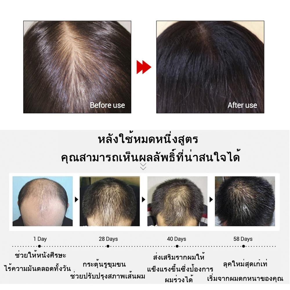 sevich-เซรั่มปลูกเครา-30ml-ปลูกคิ้ว-ปลูกหนวด-ขึ้นถาวร-น้ำยาปลูกเครา-น้ำมันหนวด-น้ำมันเครา-ยาปลูกคิ้ว-ครีมปลูกคิ้ว