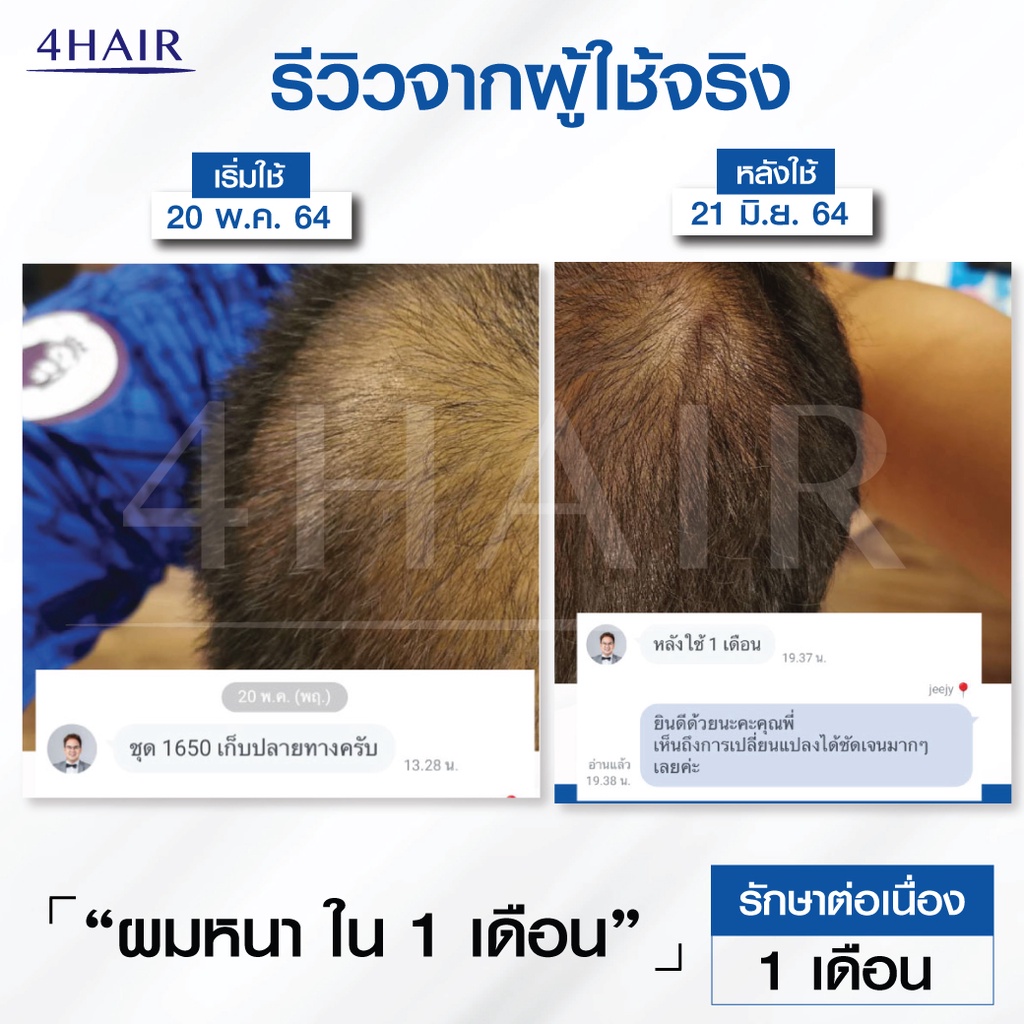 แชมพูลดผมร่วง-ผมมัน-ปรับสภาพหนังศีรษะ-4hair-เกรดคลีนิกปลูกผม