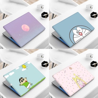 สติ๊กเกอร์ไวนิล 2 ด้านสําหรับแล็ปท็อปคอมพิวเตอร์ 11/12/13/14/15/17 นิ้ว Hp Vs X Raptor 835G7 Vs 66 4Th Generation Vs 99 450G6 / G7 / G8 Tpn-Q221