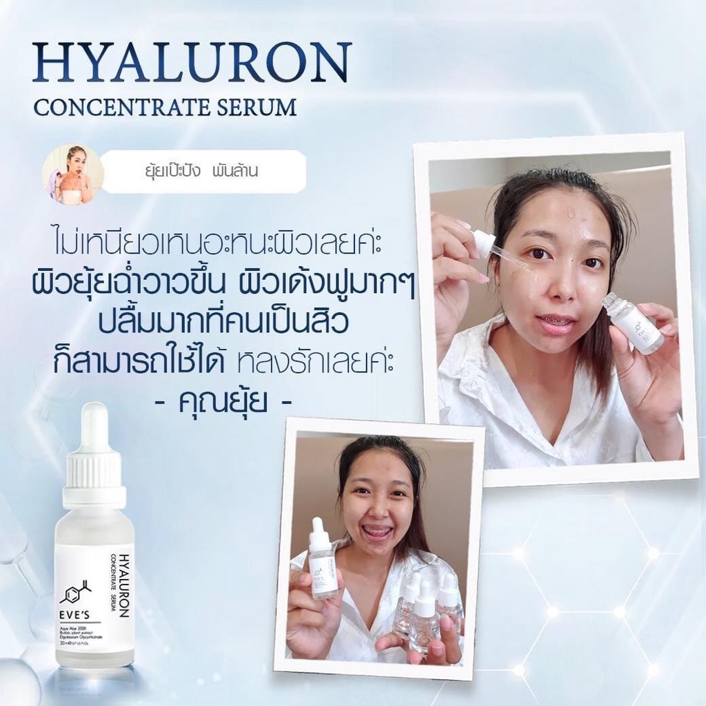 hyaluron-ไฮยาอีฟส์-ผิวฟู-เด้งเหมือนสาวเกาหลี