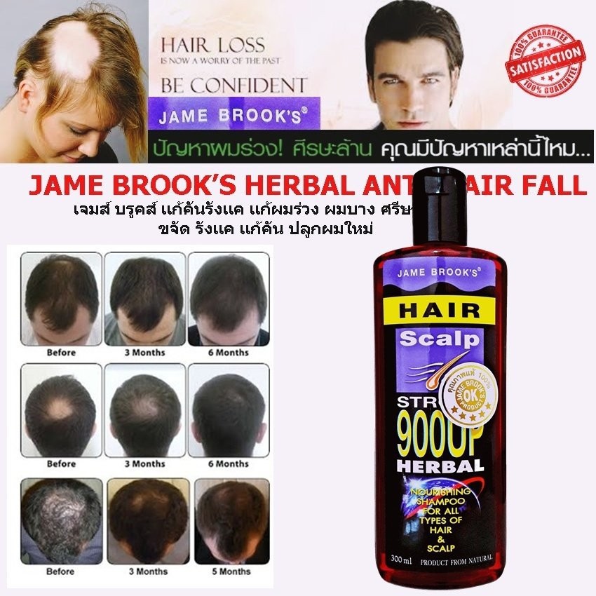 แชมพูปลูกผม-เจมส์บรูคส์-ขจัดรังแค-แก้คัน-บำรุงรากผม-jame-brook-s-herbal-anti-loss-hair-shampoo-ของแท้