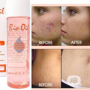 หมดอายุ10-23-bio-oil-ไบโอออยล์-บำรุงผิวแตกลาย-และ-รอยแผลเป็น-60-125-ml