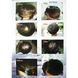 ของแท้-askar-shampoo-naturul100-อัสการ์แชมพู-ลดการหลุดร่วงของเส้นผม-เพิ่มเซลล์ผมใหม่-ขวด220ml