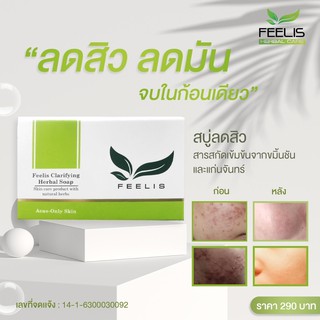 สบู่สมุนไพร Feelis สบู่สิว ดูแล ผิวหน้ามัน สิว (มี อย.)