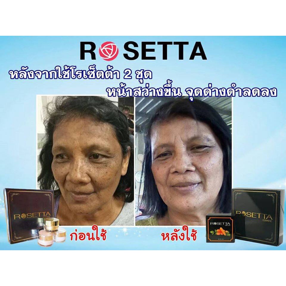 rosetta-ครีมโรเซ็ตต้า-ครีมปรับผิวหน้า