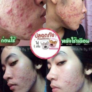 ภาพขนาดย่อของภาพหน้าปกสินค้าครีมเสต็มเซลล์กลูต้า (stem cell gluta) by st จากร้าน dudee_shopka บน Shopee