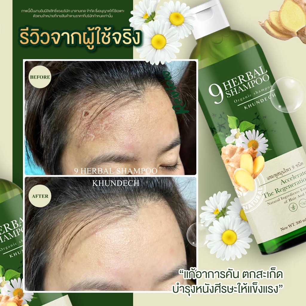 โปร-โปรเด็ด-2-แถม-1-แชมพู-ขุนเดช-แชมพูบำรุงผม-ช่วยฟื้นฟูผมร่วง-รังแค-หนังศีรษะมัน-ผมหงอก-แก้คันหนังศรีษะ-แก้เชื้อรา