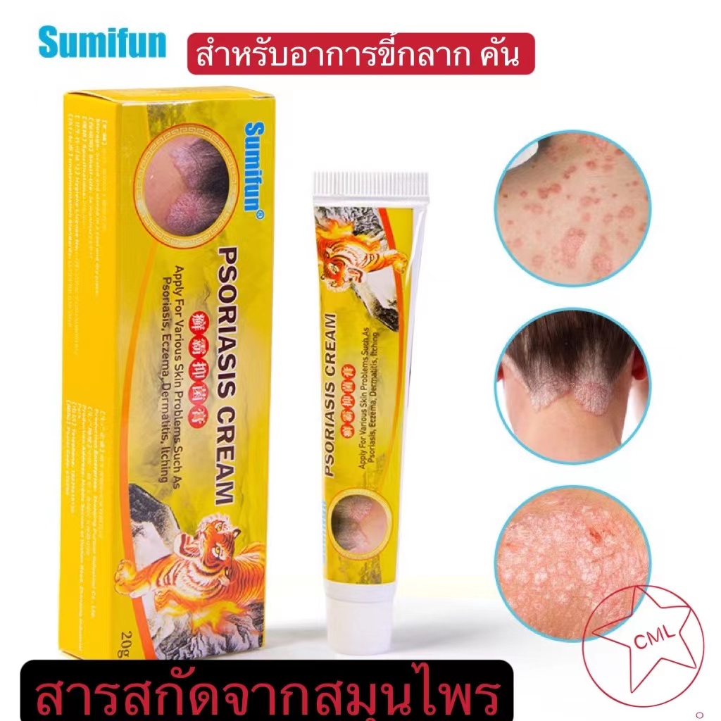 ภาพหน้าปกสินค้าsumifunเป็นต้นฉบับครีมทารักษาโรคสะเก็ดเงิน โรคผิวหนัง ยาทาโรคผิวหนัง เชื้อราน้ำกัดเท้ากลาก เกลื้อนผิวหนังอักเสบ 20gGR920