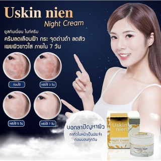 🔥พร้อมส่ง 💢Uskinnien night cream ครีมบำรุงผิวก่อนนอน   💎 ลดอาการสิวอักเสบ  ครีม ยูสกินเนี่ยน ครีมกลางคืน ไนท์ครีม