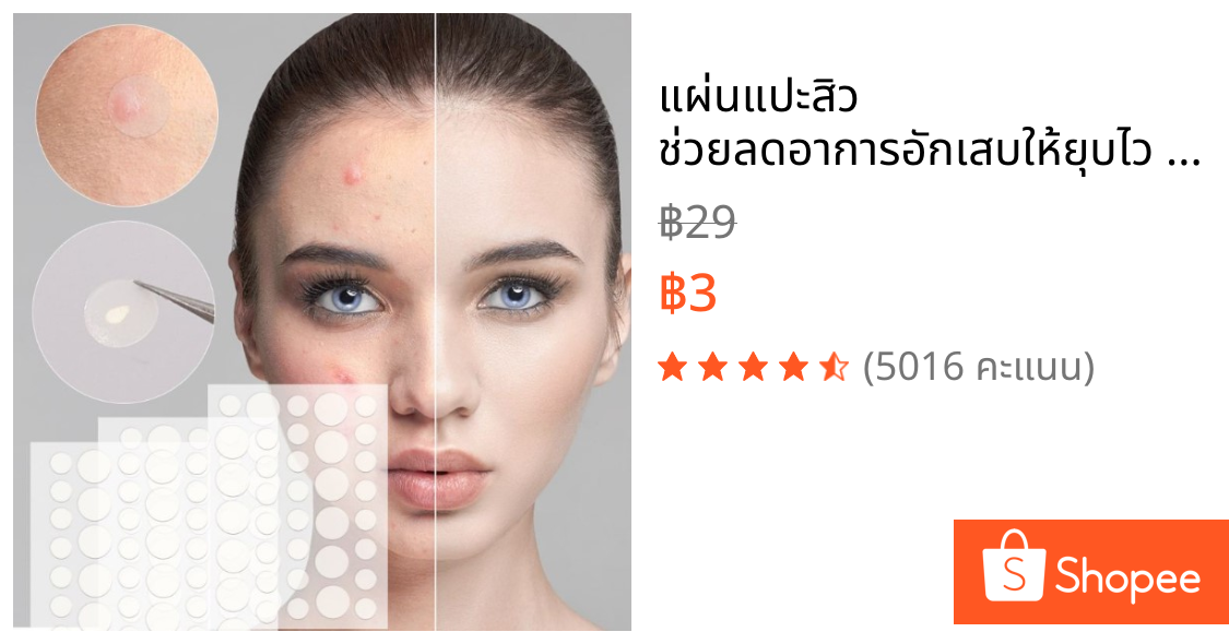 แผ่นแปะสิว ช่วยลดอาการอักเสบให้ยุบไว Salicylic Acid ช่วยดูดสิว รักษาสิว ขอบบาง กันน้ำ แต่งหน้าเนียน มี 36 ชิ้น