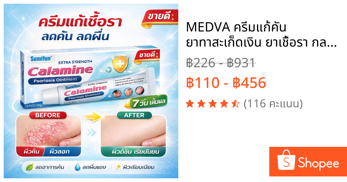 MEDVA ครีมแก้คัน ยาทาสะเก็ดเงิน ยาเชื้อรา กลาก เกลื้อน สมุนไพรสูตรเข้มข้น เห็นผลไว ส่งจากไทย