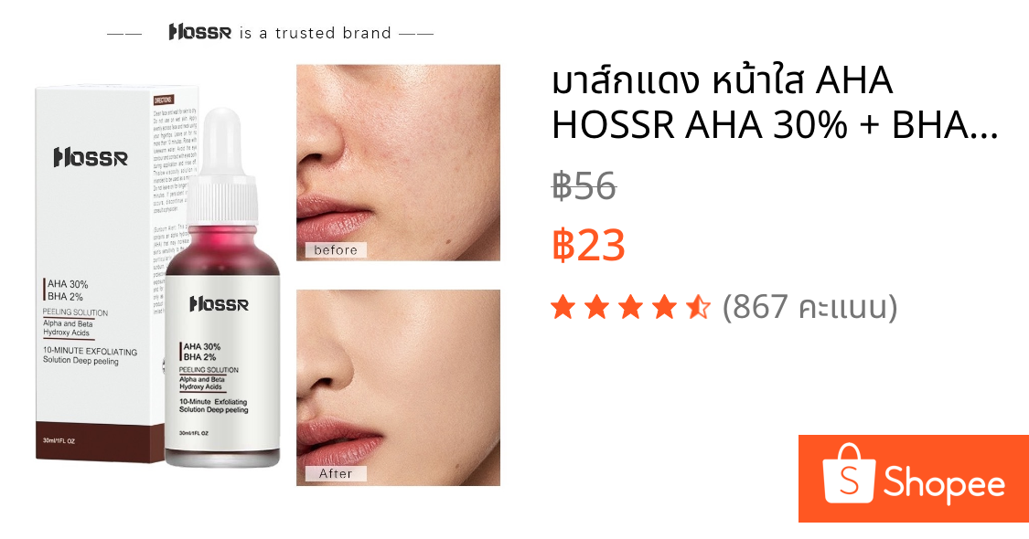 มาส์กแดง หน้าใส AHA HOSSR AHA 30% + BHA 2% ผลิตภัณฑ์ดูแลผิวหน้า กําจัดสิว ควบคุมความมัน 30 มล.